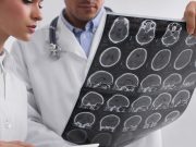 Рани предупредувања во крвта: Како да се открие мултиплекс склероза пред да се појават симптомите